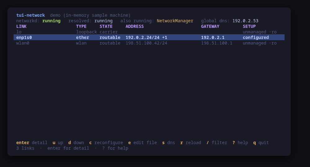 The links table: state, type, address, gateway and who manages each link